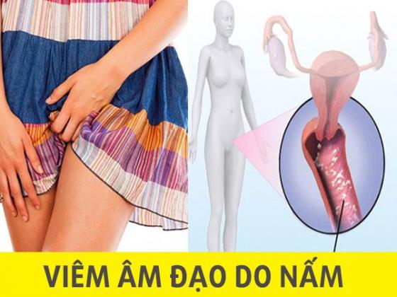 namamdaonguyennhantrieuchungvacachdieutri1_20200220152047.jpg