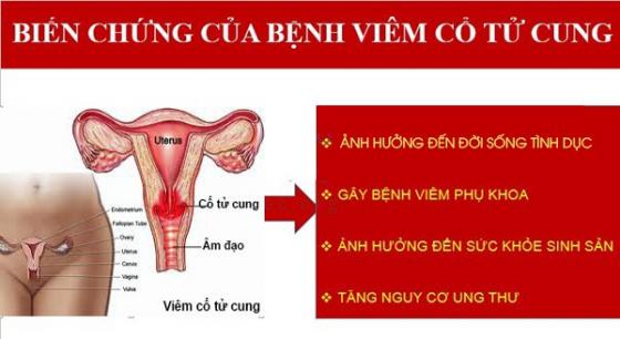 biến chứng viêm cổ tử cung.jpg