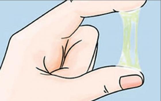 1.2-Dịch-âm-đạo-có-sự-bất-thường.jpg