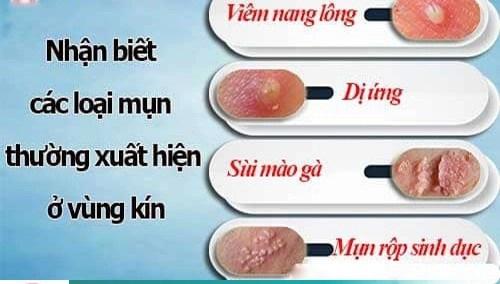 am-dao-noi-mun-2.jpg